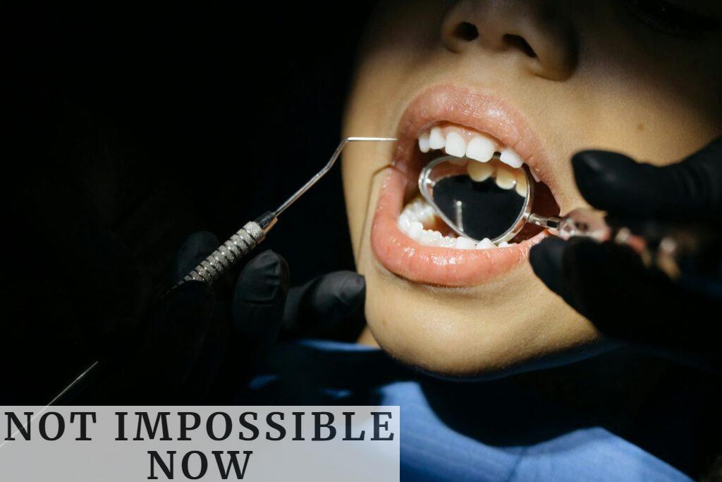 caries infantiles