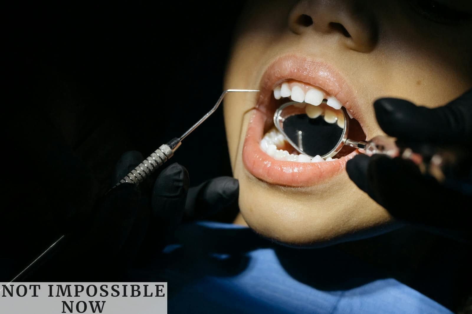 caries infantiles